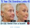 70 წლის მოხუცი "ჯადოსნური" მალამოს წასმის შემდეგ გამოიყურება,როგორც 40 წლის ქალი