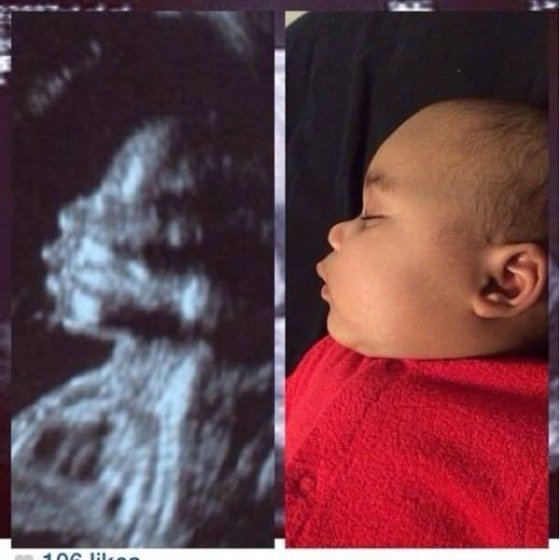 ფოტო ორსულობის დროს და დაბადების შემდეგ